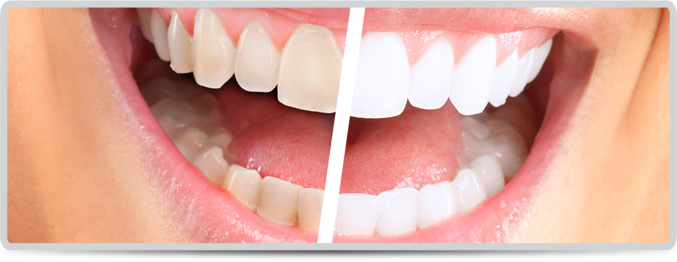 Happy smiling woman. Dental health background 